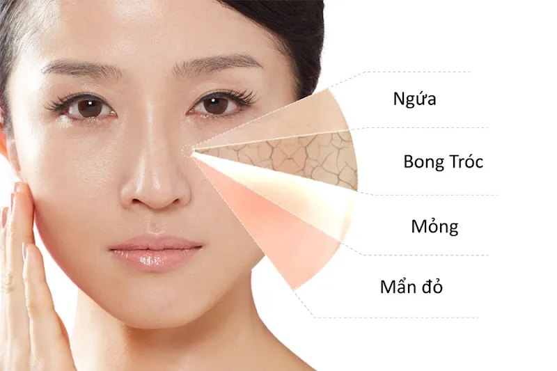 Da dầu (Oily Skin)