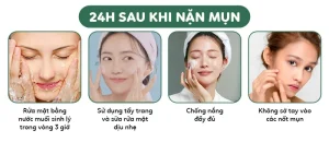 chăm sóc da sau mụn