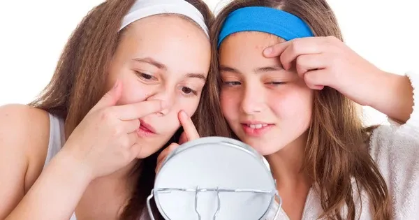 Làn da tuổi dậy thì: Những thay đổi "nổi loạn" và vấn đề thường gặp