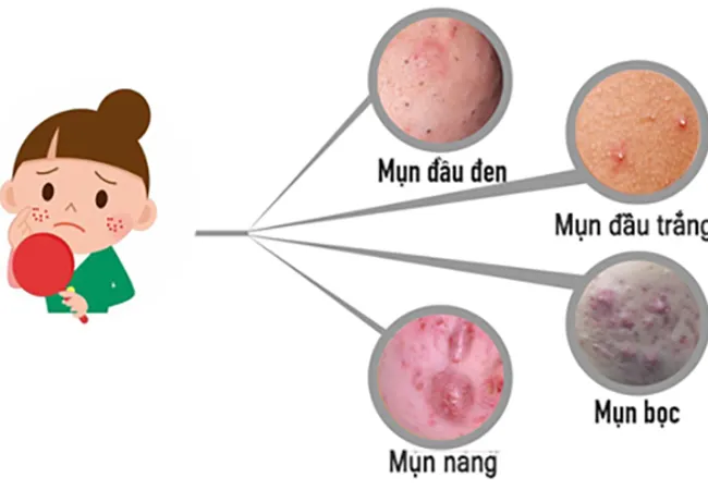 Những sai lầm cần tránh khi chăm sóc da tuổi dậy thì
